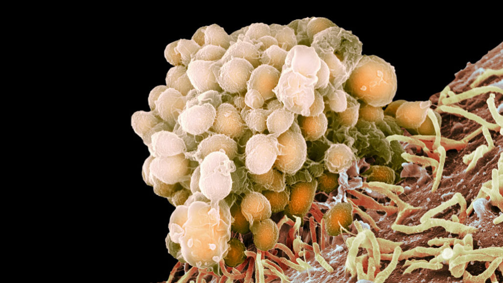 恒达登录网址 美国每年约有3.5万人死于耐药微生物